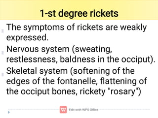 Rickets Overview Comprehensive Overview of Rickets: Causes, Symptoms, and Treatment | PDF