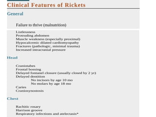 Rickets Overview Comprehensive Overview of Rickets: Causes, Diagnosis, and Treatment | PPTX