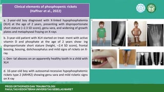 Rickets - Current Concept Review FK UNS. | PPTX