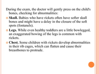 rickets- Basic, clinical presentation, treatment | PPTX
