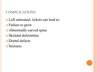 Rickets basics , pathology, diagnosis and management | PPTX