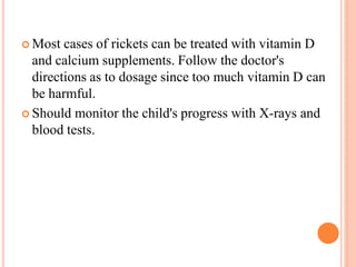 Rickets basics , pathology, diagnosis and management | PPTX