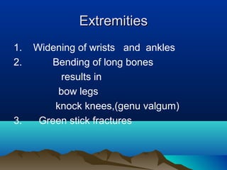 EExxttrreemmiittiieess 
1. Widening of wrists and ankles 
2. Bending of long bones 
results in 
bow legs 
knock knees,(genu valgum) 
3. Green stick fractures 
 