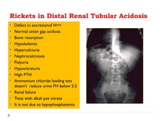 Test For Rickets rickets 6th yr 2022 in pediatric lecturer.pptx
