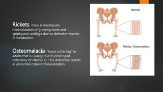 Rickets- there is inadequate
mineralization of growing bone and
epiphyseal cartilage due to defective vitamin
D metabolism
Osteomalacia- “bone softening” in
adults that is usually due to prolonged
deficiency of vitamin D. This deficiency results
in abnormal osteoid mineralization.
2
 
