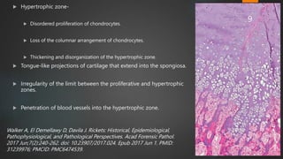  Hypertrophic zone-
 Disordered proliferation of chondrocytes.
 Loss of the columnar arrangement of chondrocytes.
 Thickening and disorganization of the hypertrophic zone.
 Tongue-like projections of cartilage that extend into the spongiosa.
 Irregularity of the limit between the proliferative and hypertrophic
zones.
 Penetration of blood vessels into the hypertrophic zone.
Walker A, El Demellawy D, Davila J. Rickets: Historical, Epidemiological,
Pathophysiological, and Pathological Perspectives. Acad Forensic Pathol.
2017 Jun;7(2):240-262. doi: 10.23907/2017.024. Epub 2017 Jun 1. PMID:
31239976; PMCID: PMC6474539.
9
 