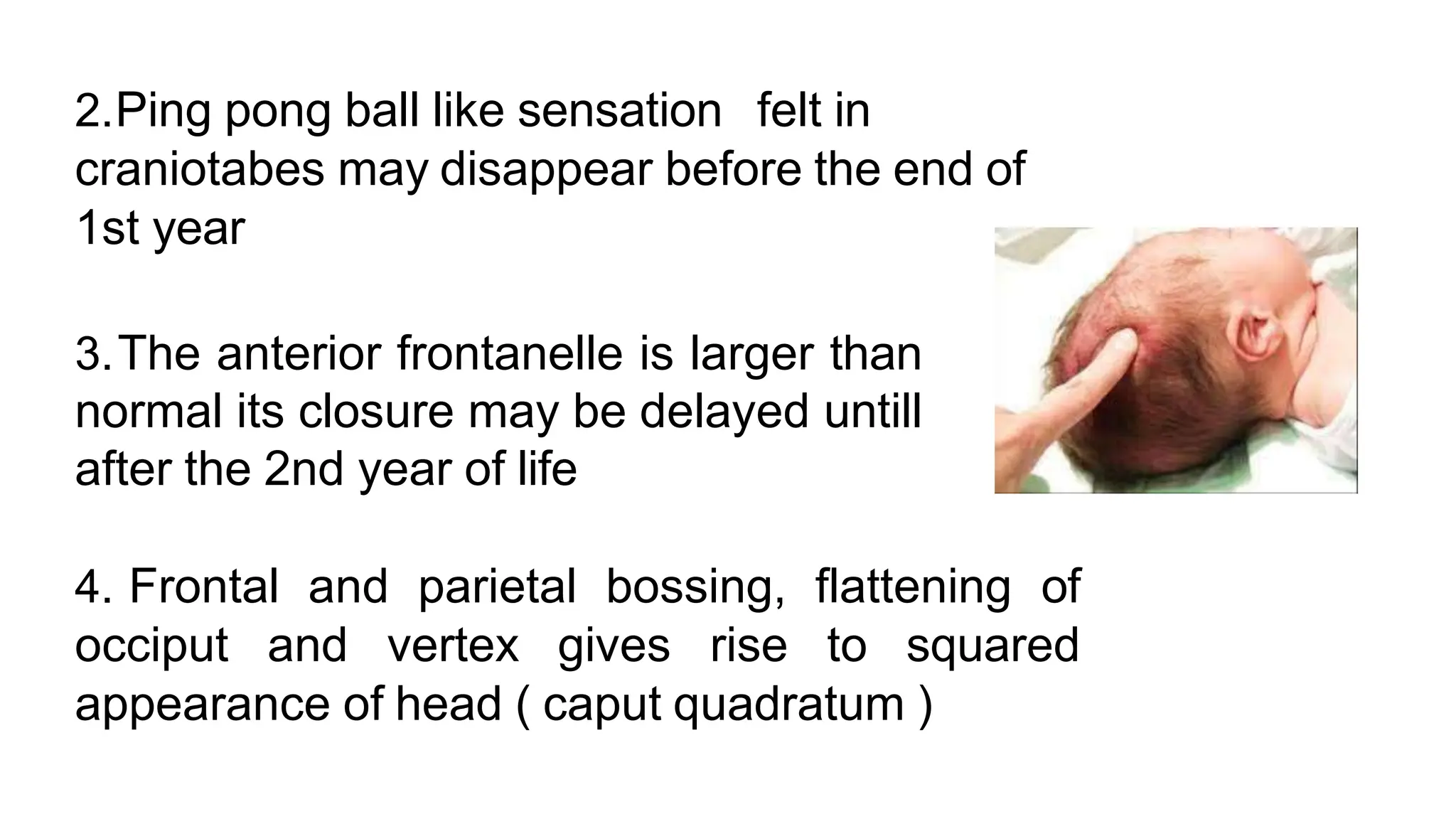 Picture of Why you think your phone is vibrating when it is not - BBC