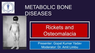 Rickets and
Osteomalacia
Presenter: Gopal Kumar Yadav
Moderator: Dr. Amit Limbu
METABOLIC BONE
DISEASES
 