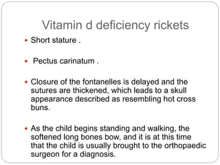 Vitamin d deficiency rickets
 Short stature .
 Pectus carinatum .
 Closure of the fontanelles is delayed and the
sutures are thickened, which leads to a skull
appearance described as resembling hot cross
buns.
 As the child begins standing and walking, the
softened long bones bow, and it is at this time
that the child is usually brought to the orthopaedic
surgeon for a diagnosis.
 
