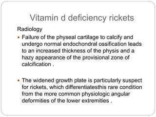 Vitamin d deficiency rickets
Radiology
 Failure of the physeal cartilage to calcify and
undergo normal endochondral ossification leads
to an increased thickness of the physis and a
hazy appearance of the provisional zone of
calcification .
 The widened growth plate is particularly suspect
for rickets, which differentiatesthis rare condition
from the more common physiologic angular
deformities of the lower extremities .
 