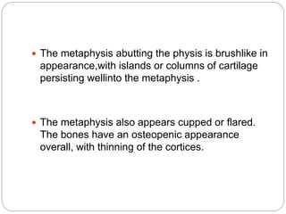  The metaphysis abutting the physis is brushlike in
appearance,with islands or columns of cartilage
persisting wellinto the metaphysis .
 The metaphysis also appears cupped or flared.
The bones have an osteopenic appearance
overall, with thinning of the cortices.
 