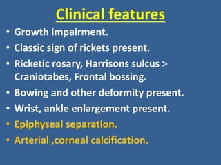 Clinical features
• Growth impairment.
• Classic sign of rickets present.
• Ricketic rosary, Harrisons sulcus >
Craniotabes, Frontal bossing.
• Bowing and other deformity present.
• Wrist, ankle enlargement present.
• Epiphyseal separation.
• Arterial ,corneal calcification.
 