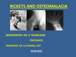 RICKETS AND OSTEOMALACIA
MODERATOR: DR. P. TAHBILDAR,
PROF&HOD
PRESENTER: DR. S.H.RANNA, PGT
20-04-2016
 