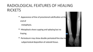 rickets class saurabh.presentation management | PPTX