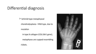 Table Rickets Differential rickets class saurabh.presentation management | PPTX