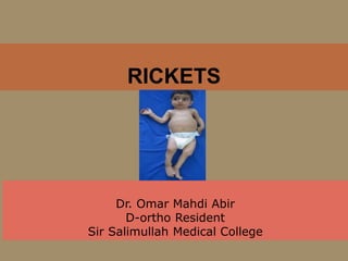 Dr. Omar Mahdi Abir
D-ortho Resident
Sir Salimullah Medical College
RICKETS
 