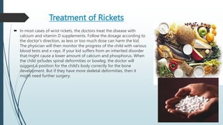 RICKETS HYPERVITAMIN, SPASMOPHILIA MANDEEP SINGH.pptx