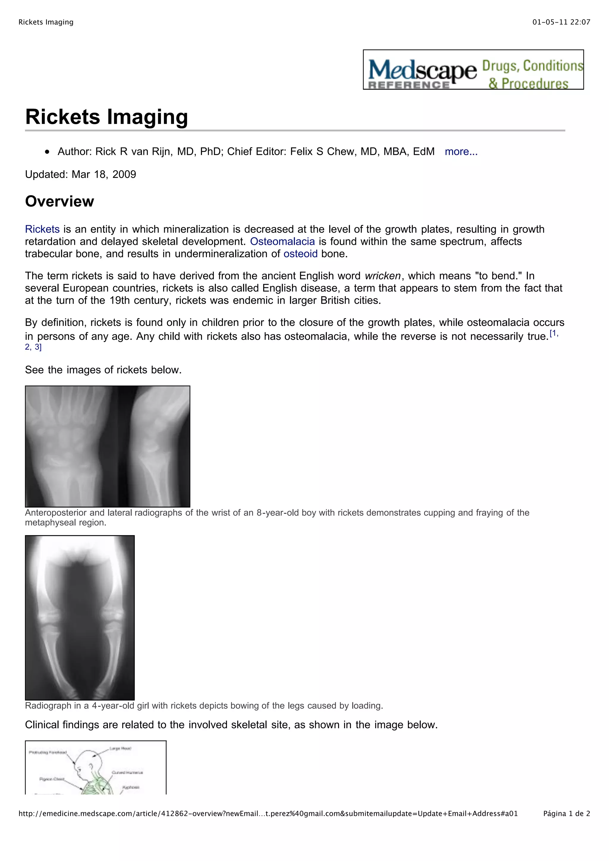 Rickets imaging | PDF