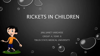 RICKETS IN CHILDREN 
JINU JANET VARGHESE 
GROUP :4, YEAR :6 
TBILISI STATE MEDICAL UNIVERSITY 
 