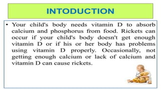 Rickets in children ppt.pptx in pediatric patient | PPT