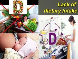 Lack of
dietary Intake

 
