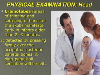 PHYSICAL EXAMINATION: Head
Craniotabes (areas
of thinning and
softening of bones of
the skull) manifests
early in infants older
than 2−3 months.
It detected by pressing
firmly over the
occiput or posterior
parietal bones. A
ping-pong-ball
sensation will be felt.


 