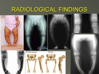 RADIOLOGICAL FINDINGS

 