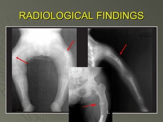 RADIOLOGICAL FINDINGS

 