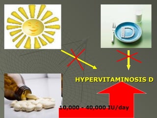 HYPERVITAMINOSIS D

10,000 - 40,000 IU/day

 