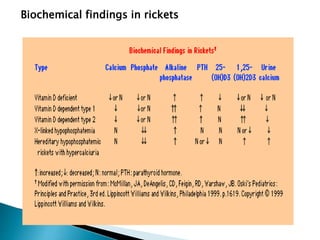 Rickets Lesson | PPTX