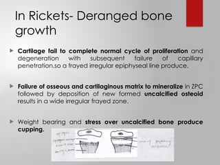 Rickets (nasrum seminar) nutritional and others | PPTX
