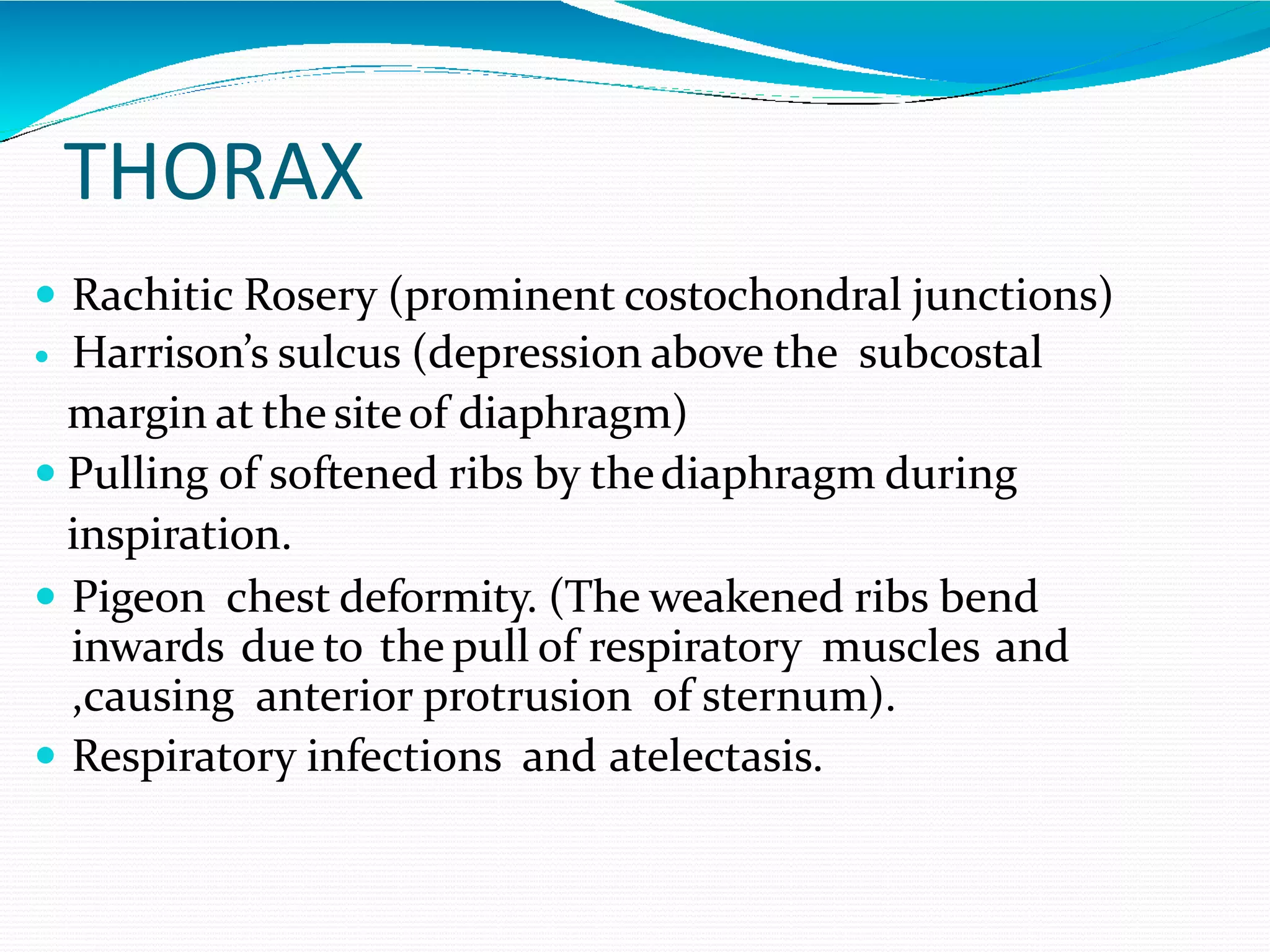Rickets & osteomalacia | PPTX