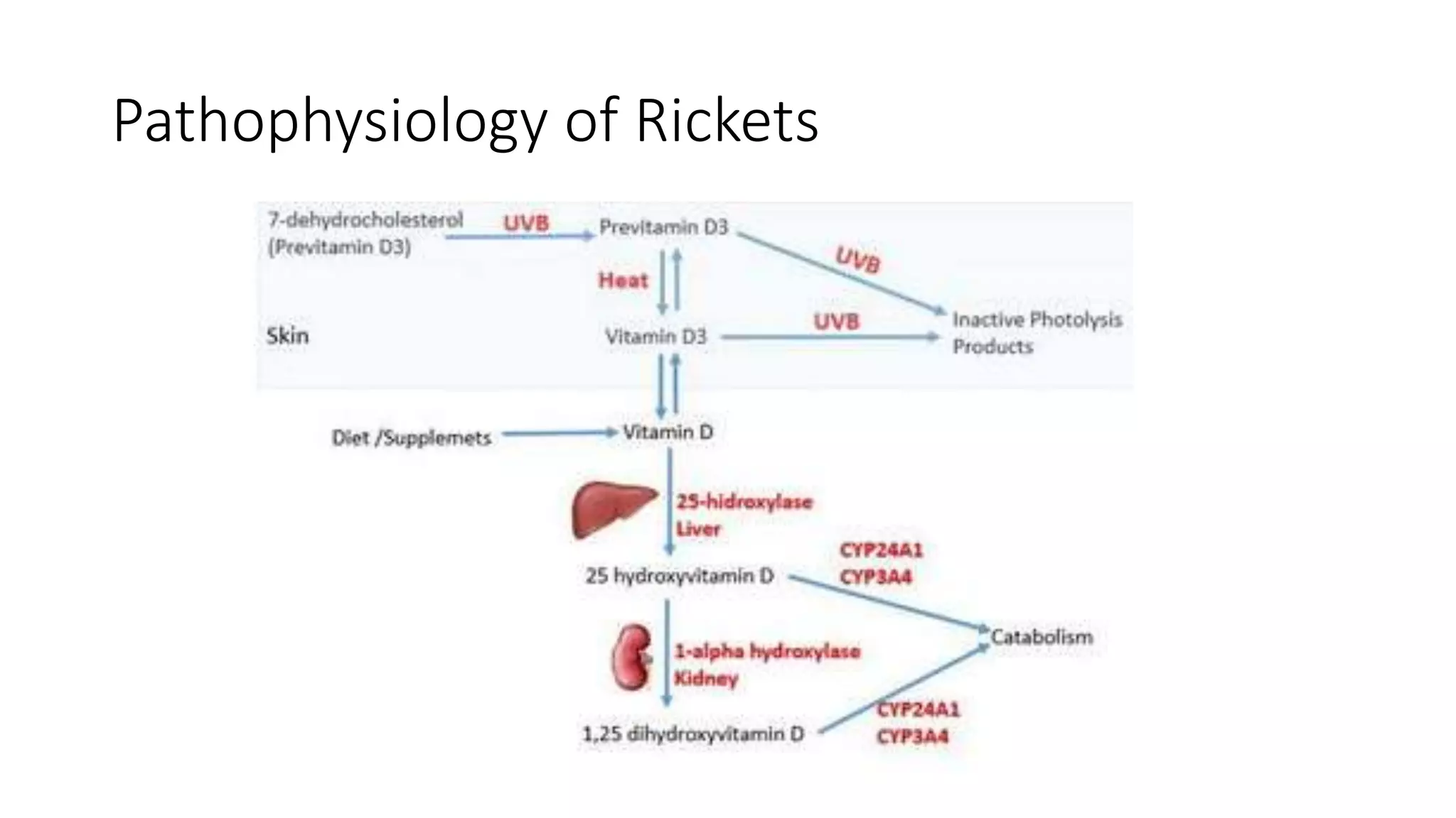 Rickets & Osteomalacia.pptx