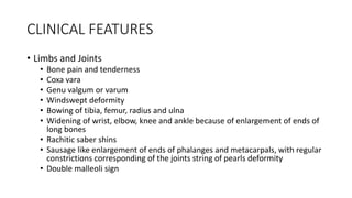 CLINICAL FEATURES
• Limbs and Joints
• Bone pain and tenderness
• Coxa vara
• Genu valgum or varum
• Windswept deformity
• Bowing of tibia, femur, radius and ulna
• Widening of wrist, elbow, knee and ankle because of enlargement of ends of
long bones
• Rachitic saber shins
• Sausage like enlargement of ends of phalanges and metacarpals, with regular
constrictions corresponding of the joints string of pearls deformity
• Double malleoli sign
 