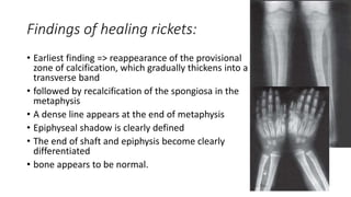 Findings of healing rickets:
• Earliest finding => reappearance of the provisional
zone of calcification, which gradually thickens into a
transverse band
• followed by recalcification of the spongiosa in the
metaphysis
• A dense line appears at the end of metaphysis
• Epiphyseal shadow is clearly defined
• The end of shaft and epiphysis become clearly
differentiated
• bone appears to be normal.
 
