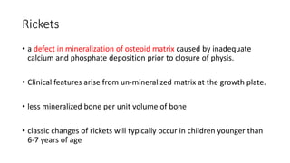 Rickets
• a defect in mineralization of osteoid matrix caused by inadequate
calcium and phosphate deposition prior to closure of physis.
• Clinical features arise from un-mineralized matrix at the growth plate.
• less mineralized bone per unit volume of bone
• classic changes of rickets will typically occur in children younger than
6-7 years of age
 