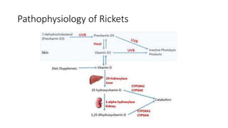 Pathophysiology of Rickets
 