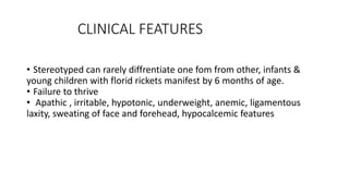 RICKETS & OSTEOMALACIA.pptx