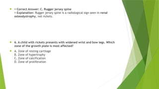 metabolic bone disease rickets osteomalacia .pptx