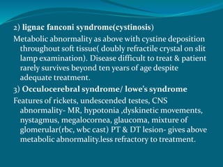 2) lignac fanconi syndrome(cystinosis)
Metabolic abnormality as above with cystine deposition
throughout soft tissue( doubly refractile crystal on slit
lamp examination). Disease difficult to treat & patient
rarely survives beyond ten years of age despite
adequate treatment.
3) Occulocerebral syndrome/ lowe’s syndrome
Features of rickets, undescended testes, CNS
abnormality- MR, hypotonia ,dyskinetic movements,
nystagmus, megalocornea, glaucoma, mixture of
glomerular(rbc, wbc cast) PT & DT lesion- gives above
metabolic abnormality.less refractory to treatment.
 