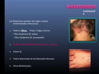 Ricketssiosis sector salud | PPT