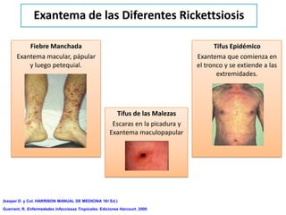 Exantema de las Diferentes Rickettsiosis

           Fiebre Manchada                                                              Tifus Epidémico
       Exantema macular, pápular                                                  Exantema que comienza en
           y luego petequial.                                                     el tronco y se extiende a las
                                                                                         extremidades.




                                                        Tifus de las Malezas
                                                       Escaras en la picadura y
                                                      Exantema maculopapular




(kasper D. y Col. HARRISON MANUAL DE MEDICINA 16ª Ed.)

Guerrant, R. Enfermedades infecciosas Tropicales. Ediciones Harcourt. 2000
 