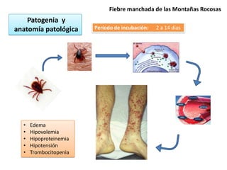 Fiebre manchada de las Montañas Rocosas
    Patogenia y
anatomía patológica     Período de incubación:   2 a 14 días




  •   Edema
  •   Hipovolemia
  •   Hipoproteinemia
  •   Hipotensión
  •   Trombocitopenia
 