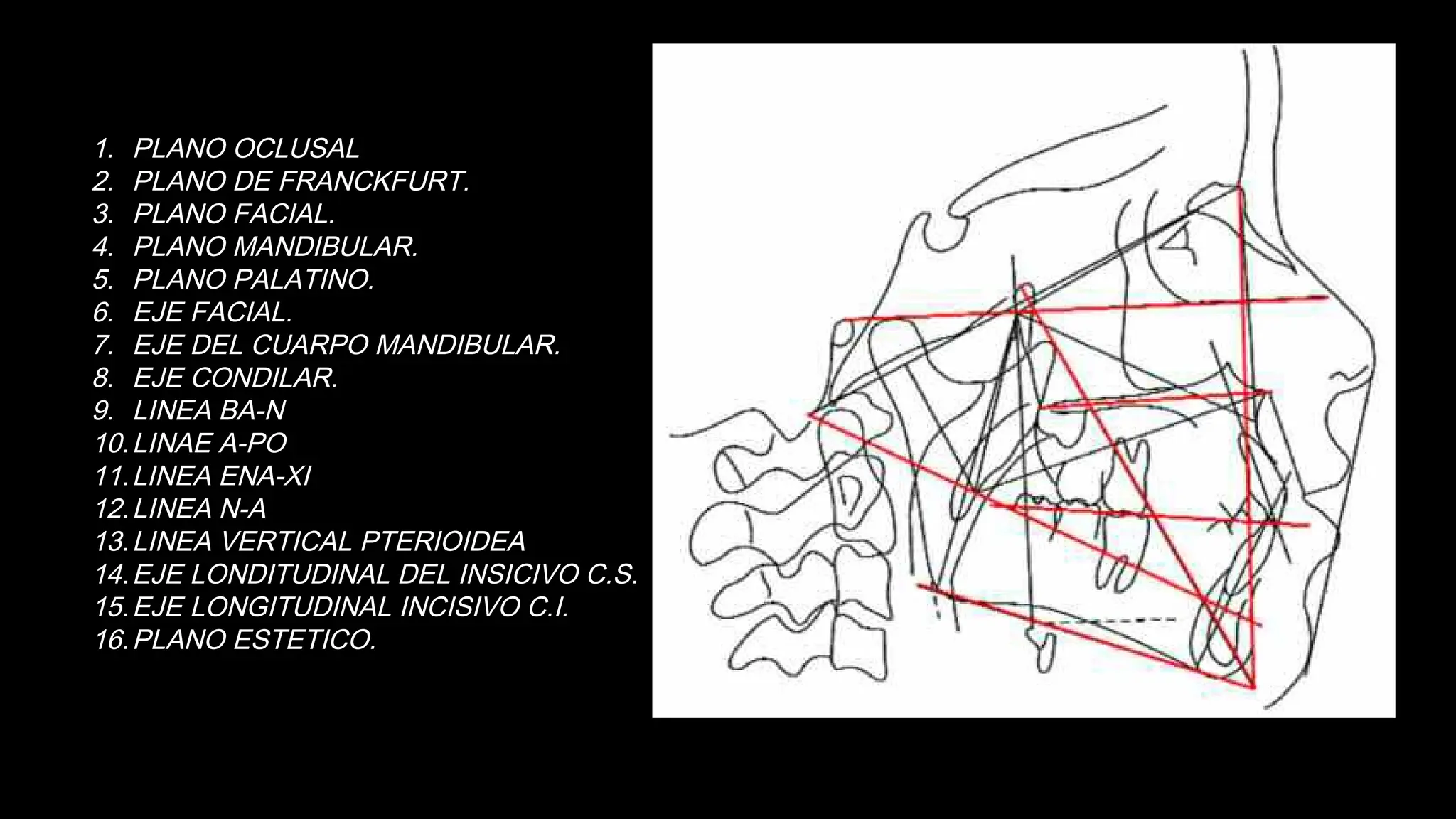 Ricketts Line Analisis de Cefalometría de RICKETTS y ricketts simplificado | PPTX