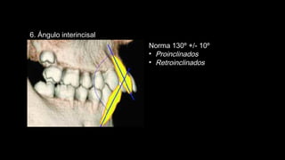 Analisis de Cefalometría de RICKETTS y ricketts simplificado | PPTX