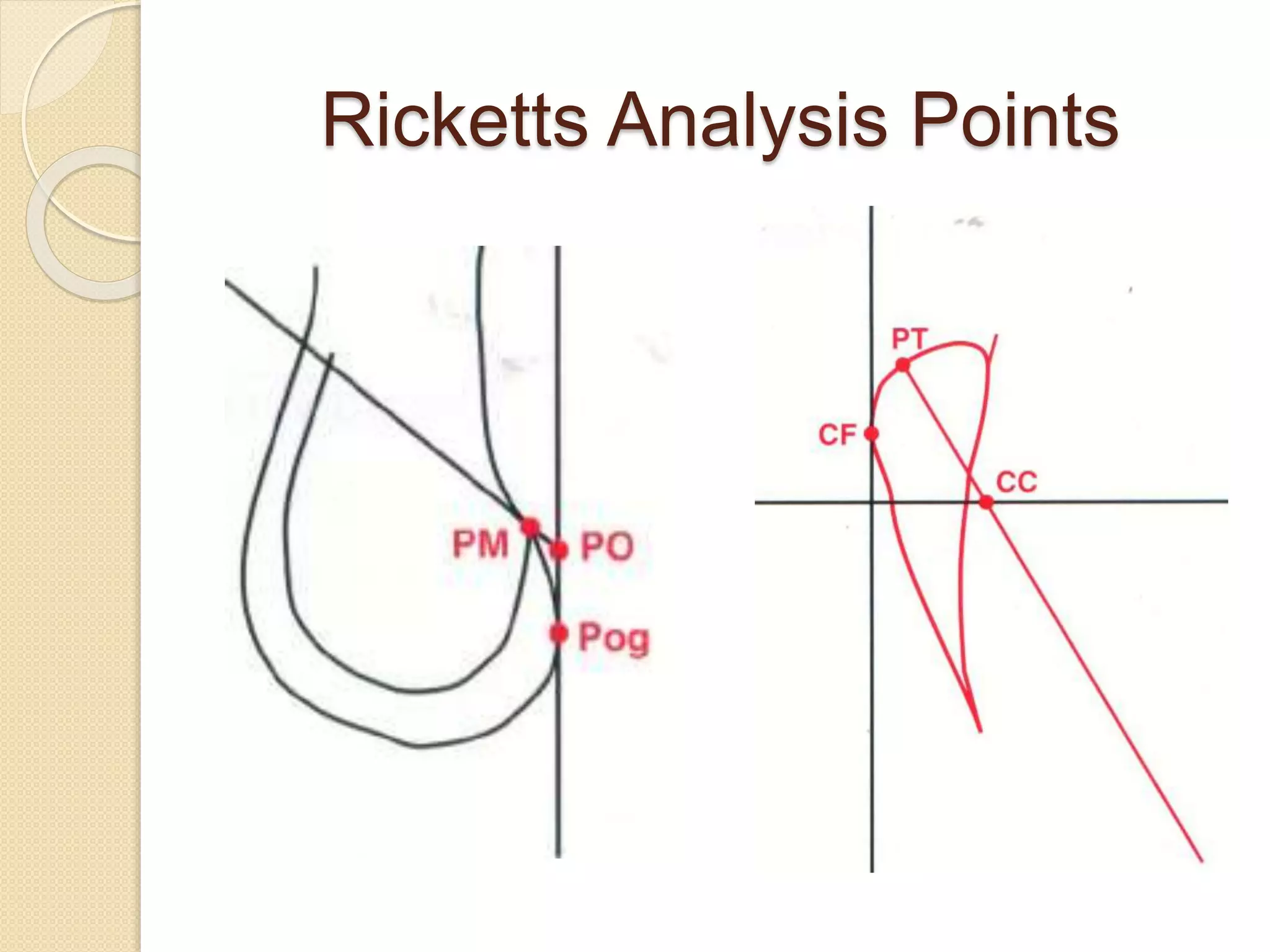 Ricketts analysis | PPTX