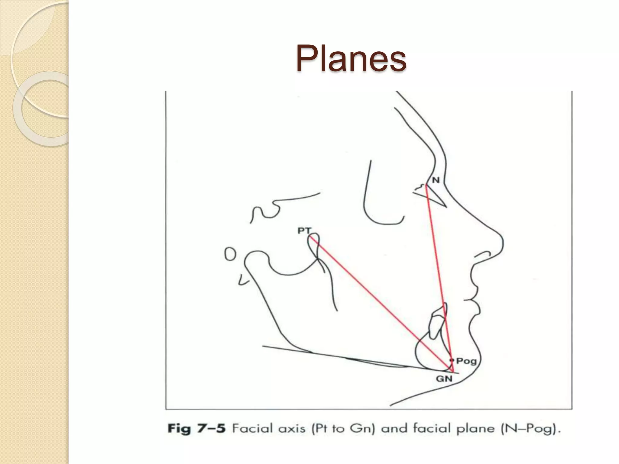 Ricketts Line Ricketts analysis | PPTX