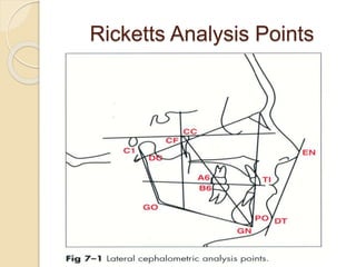 Ricketts Analysis Points
 