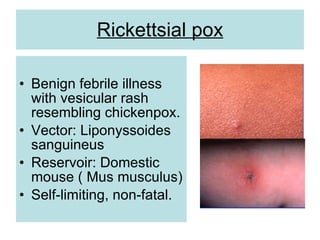 Rickettsial pox
• Benign febrile illness
with vesicular rash
resembling chickenpox.
• Vector: Liponyssoides
sanguineus
• Reservoir: Domestic
mouse ( Mus musculus)
• Self-limiting, non-fatal.
 