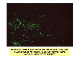 IMMUNOFLUORESCENT ANTIBODY TECHNIQUE – UTILISES
FLUORESCENT ANTIBODY TO DETECT RICKETTSIAL
ANTIGEN IN INFECTED TISSUES
 